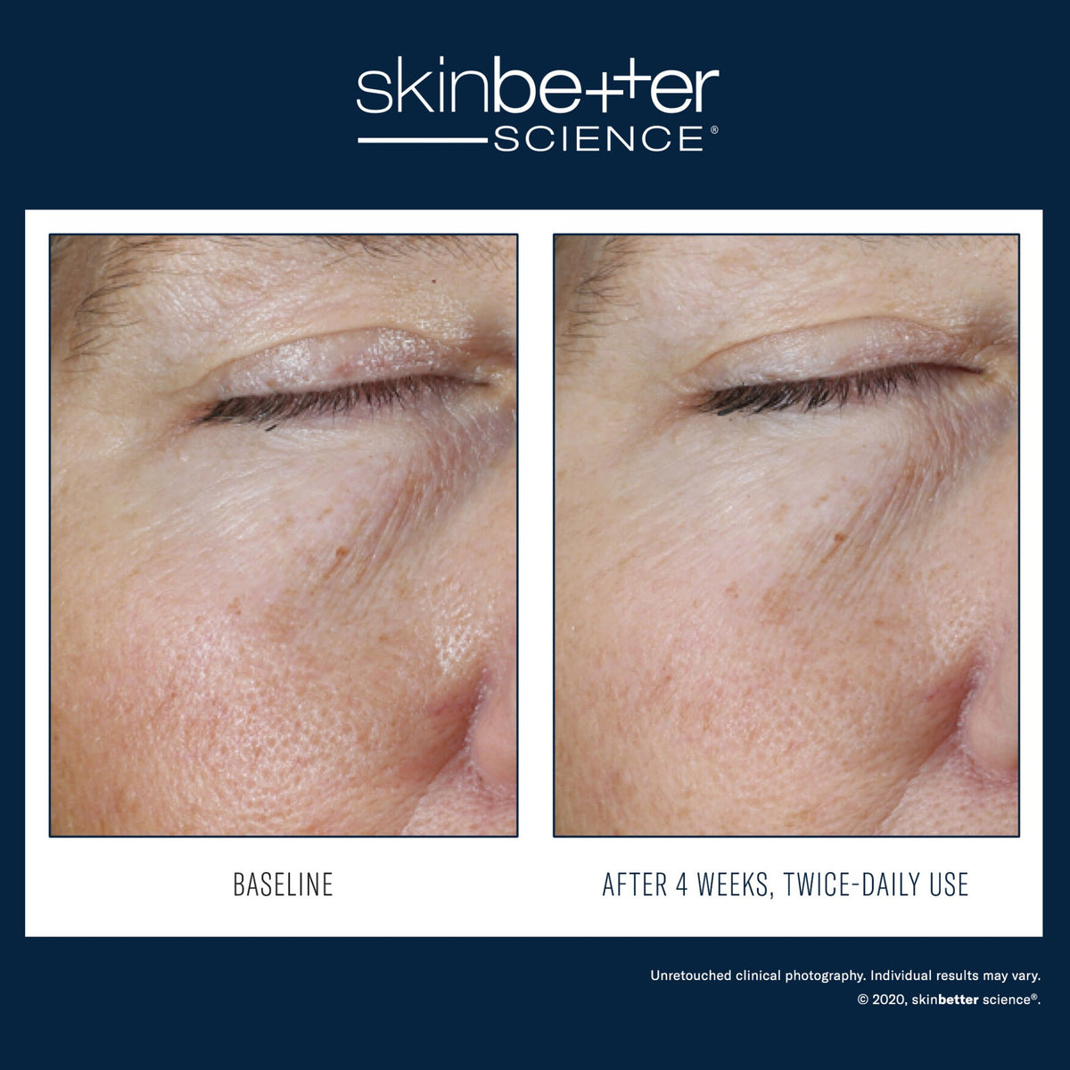 SkinBetter Science Instant Effect Gel EYE lifestyle image