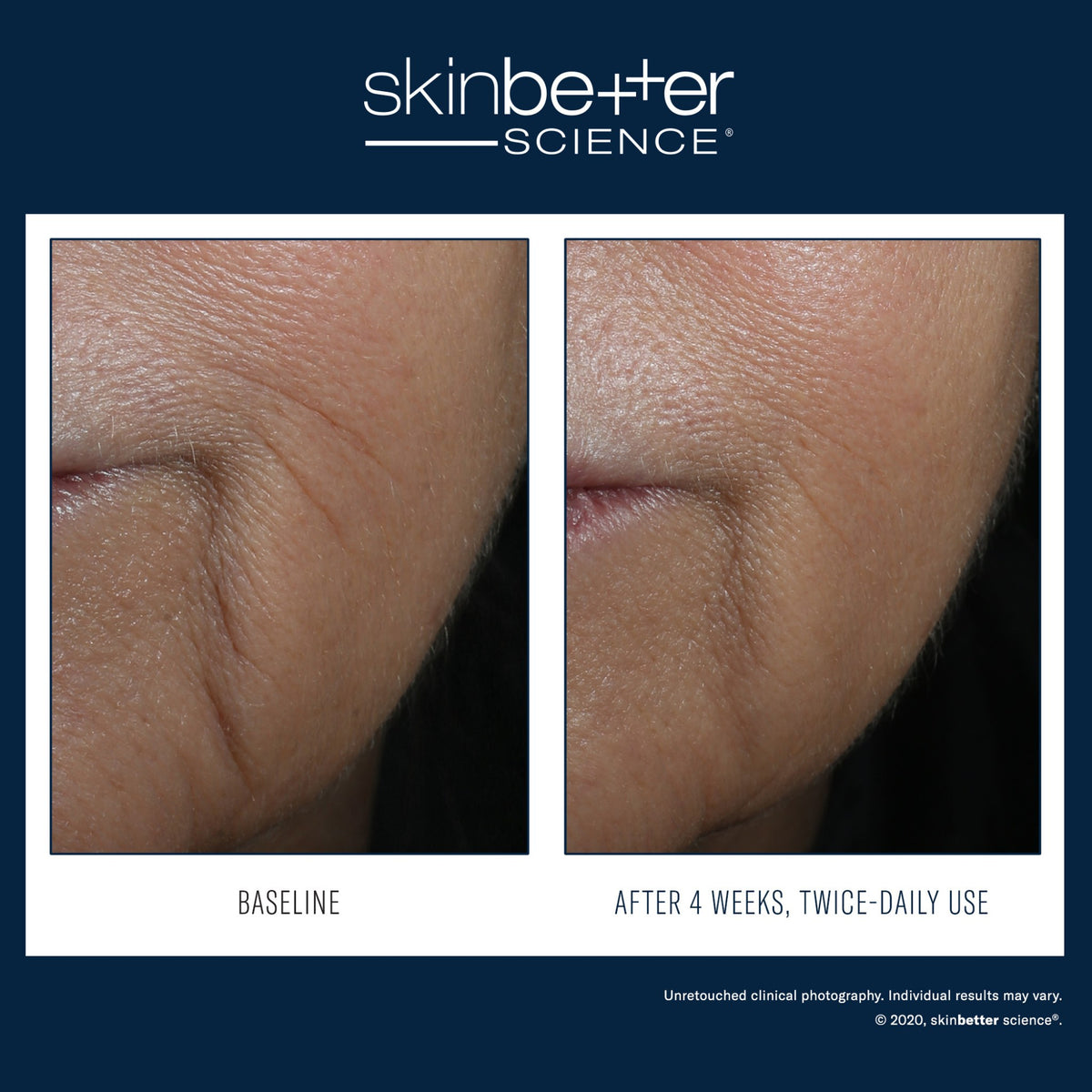 SkinBetter Science InterFuse Treatment LINES lifestyle image