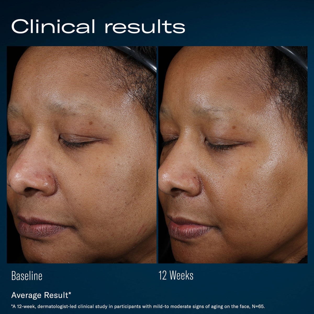 SkinBetter Science Ampra Volumizing Macro HA Serum lifestyle image