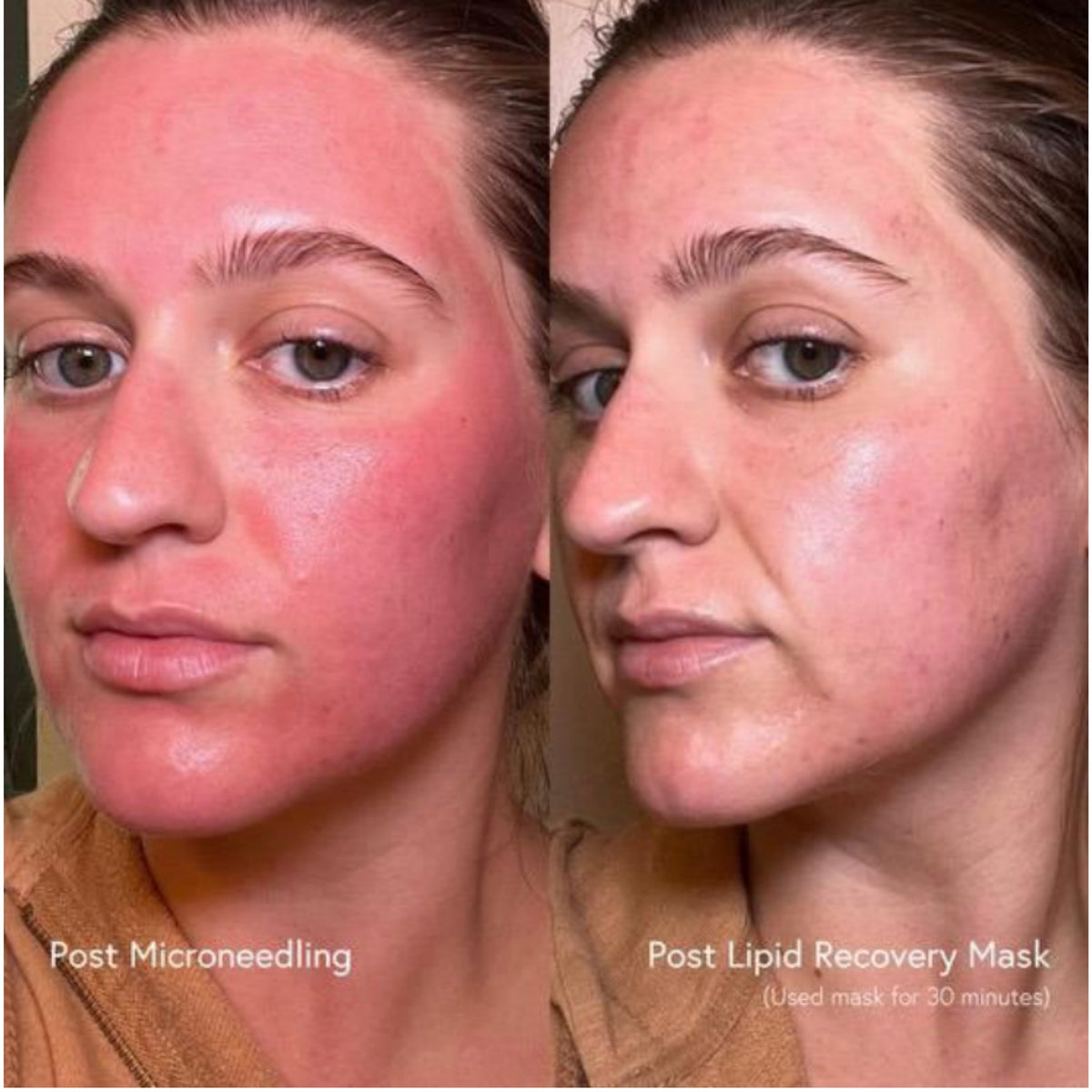 Epicutis Lipid Recovery Mask lifestyle image
