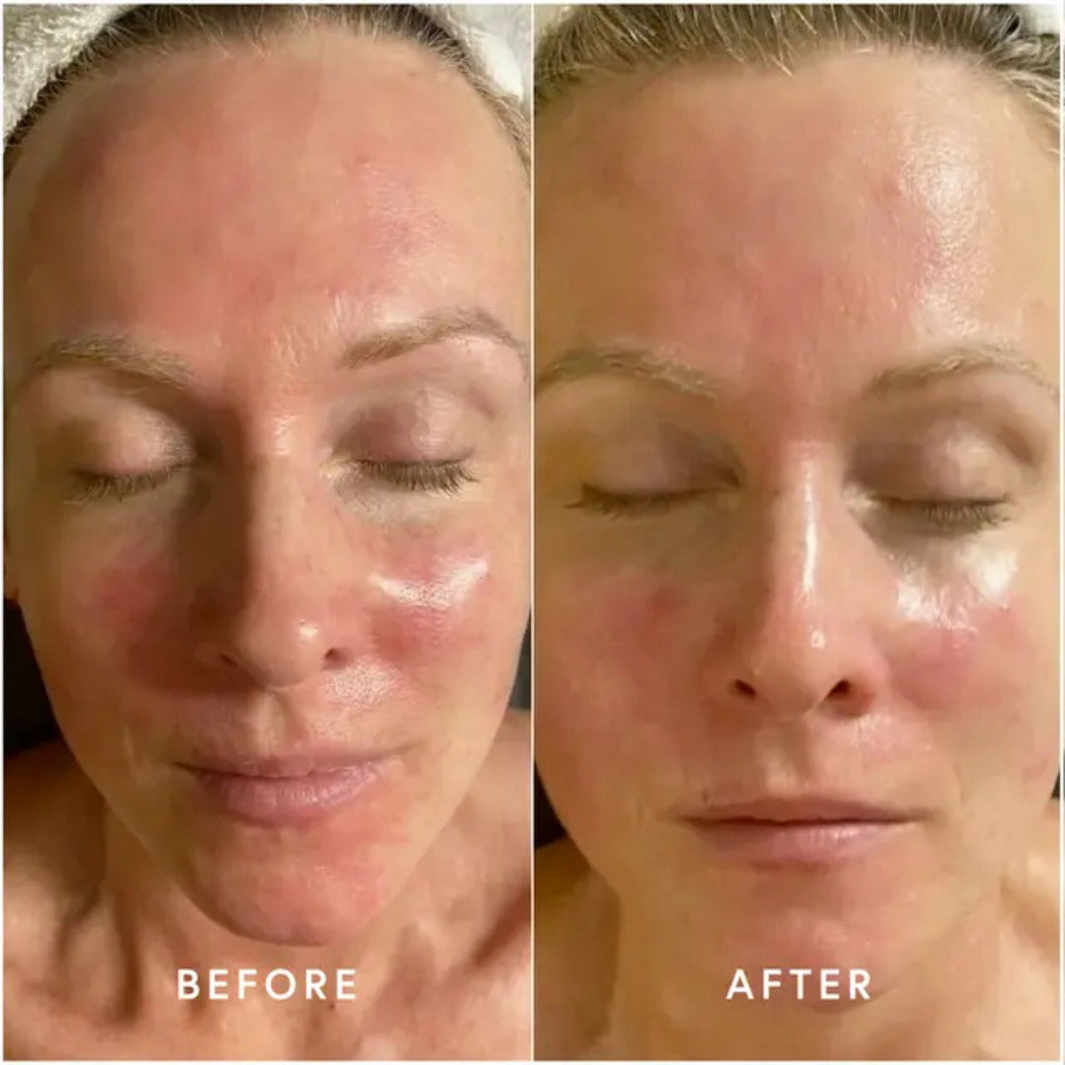 Epicutis Hyvia Crème lifestyle image