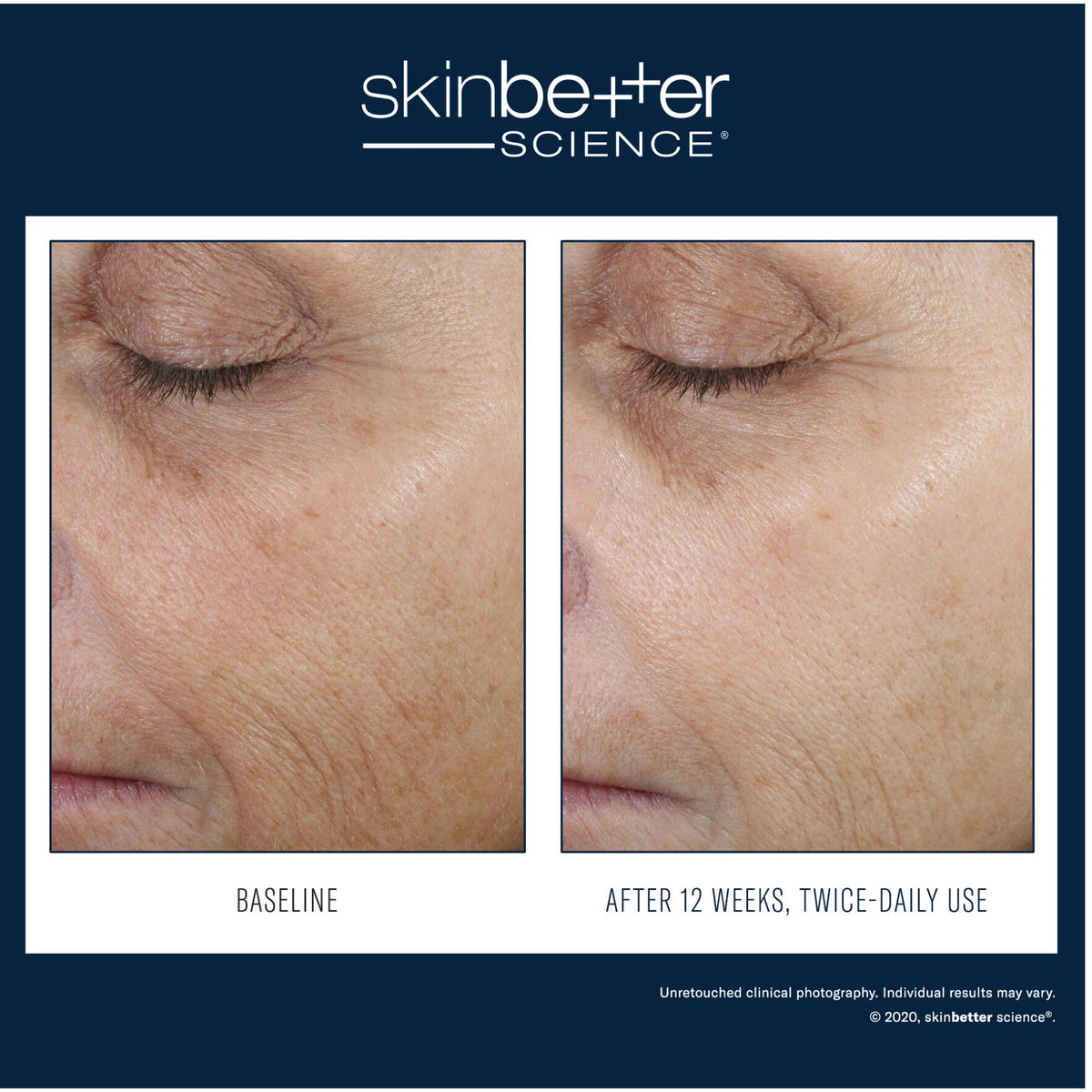 SkinBetter Science Even Tone Correcting Serum lifestyle image