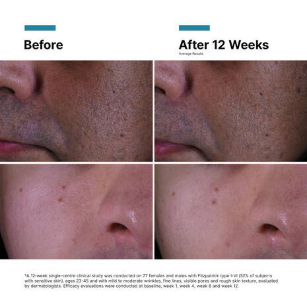 SkinCeuticals P-TIOX Cream lifestyle image