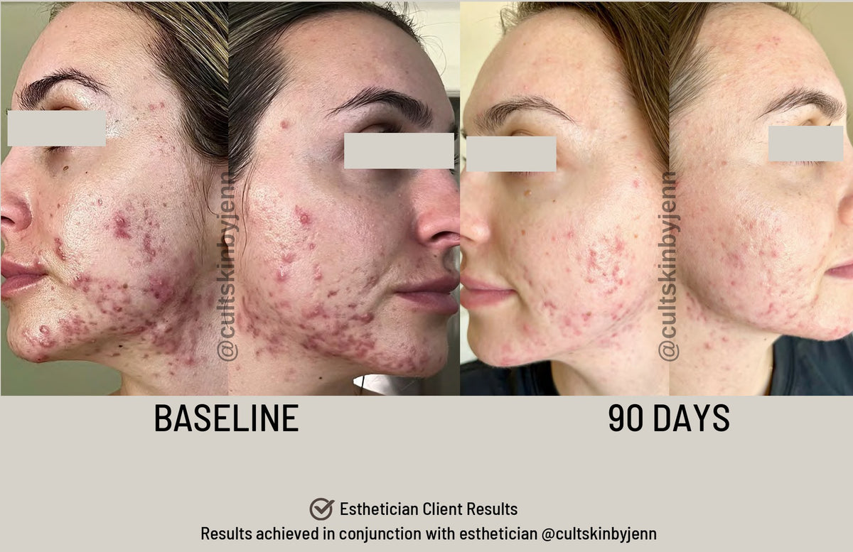 SIV Biome Balancing Serum lifestyle image