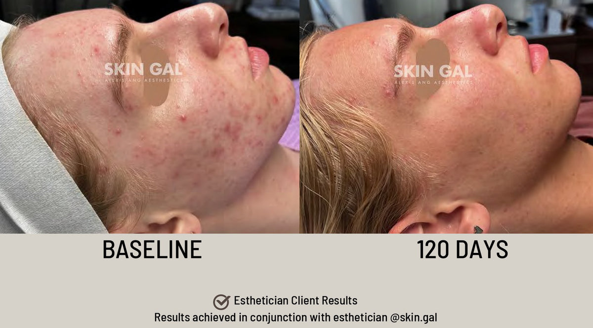 SIV Biome Balancing Serum lifestyle image