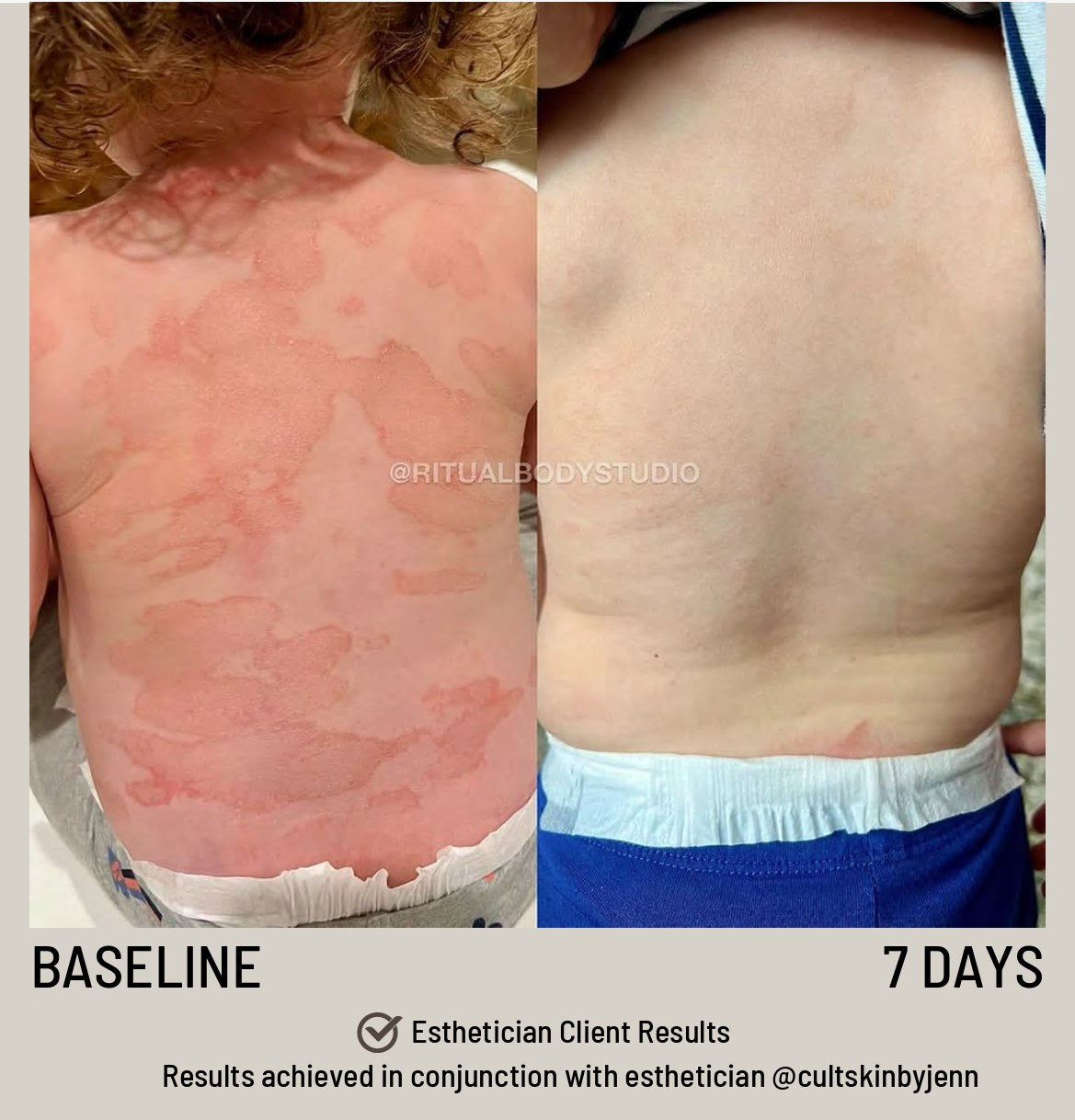 SIV Biome Balancing Serum lifestyle image