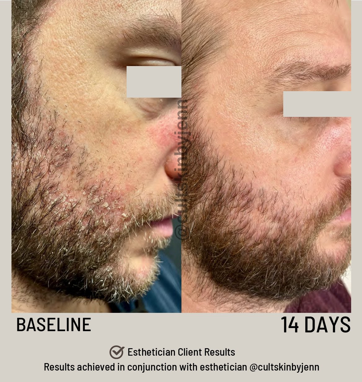 SIV Biome Balancing Serum lifestyle image