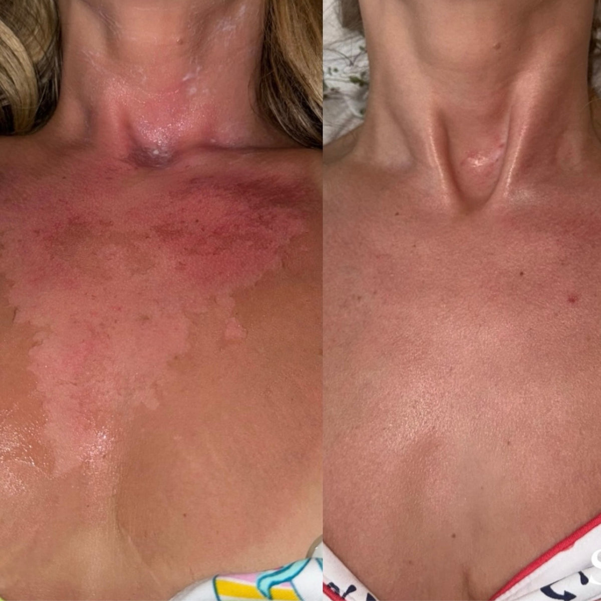 SIV Biome Balancing Serum lifestyle image