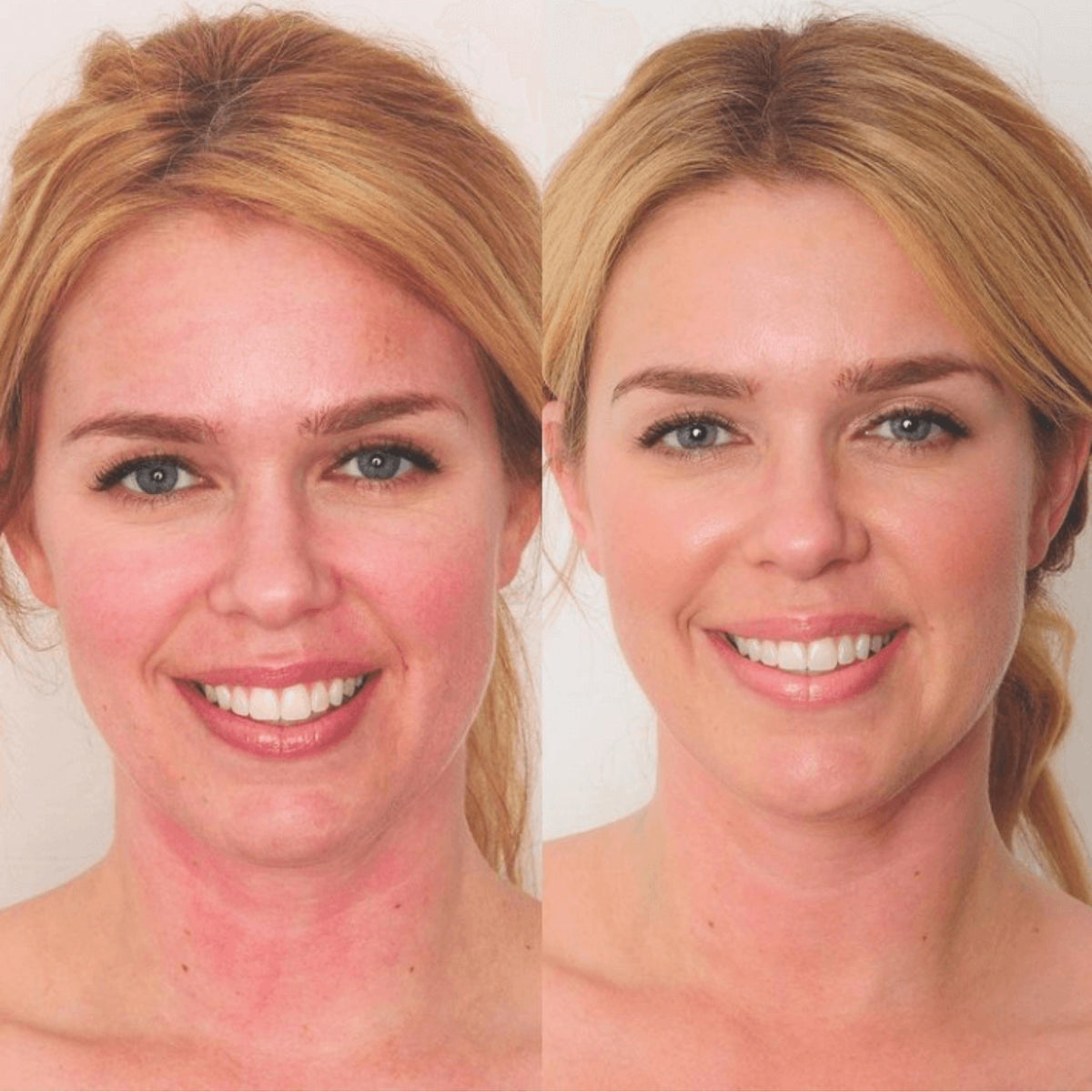 Bend Beauty Renew + Protect Mini Softgels lifestyle image