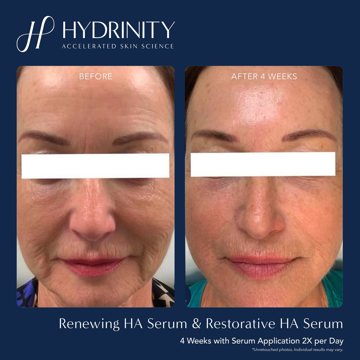 HYDRINITY Renewing HA Serum lifestyle image