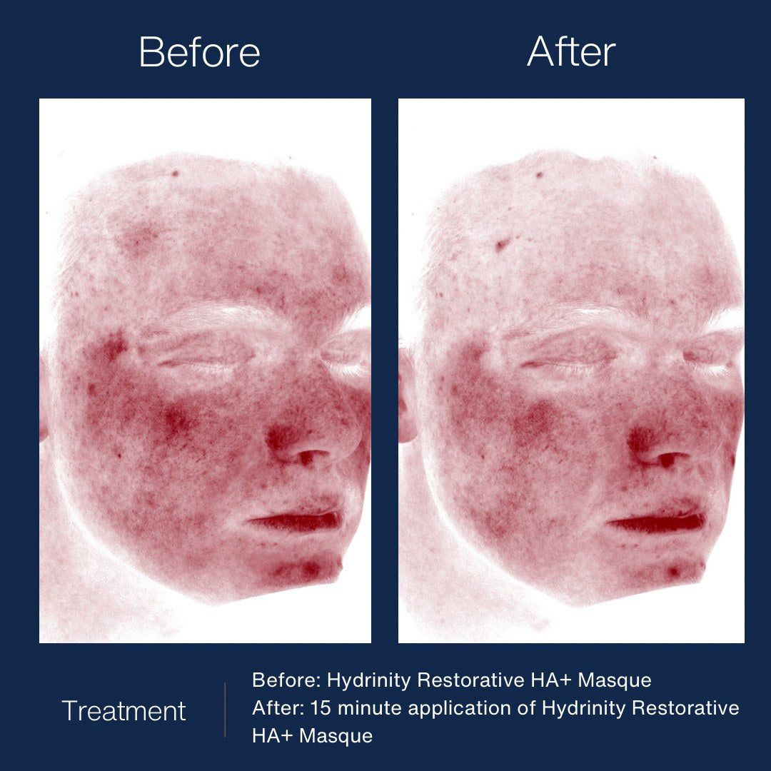 HYDRINITY Restorative HA+ Masque lifestyle image