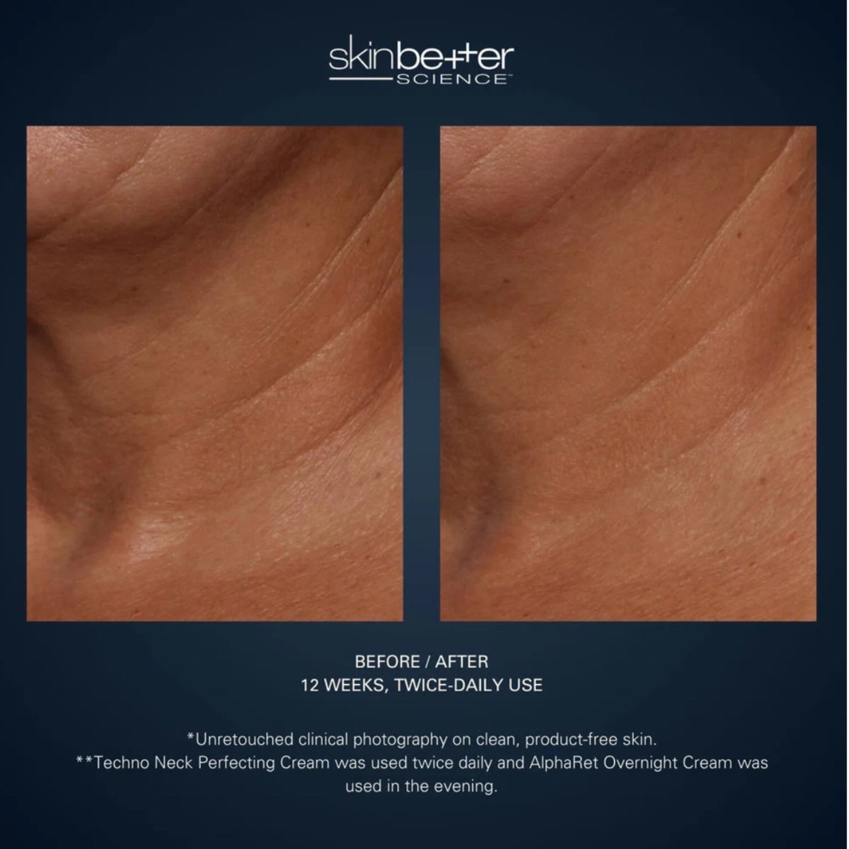 SkinBetter Science Techno Neck Perfecting Cream lifestyle image