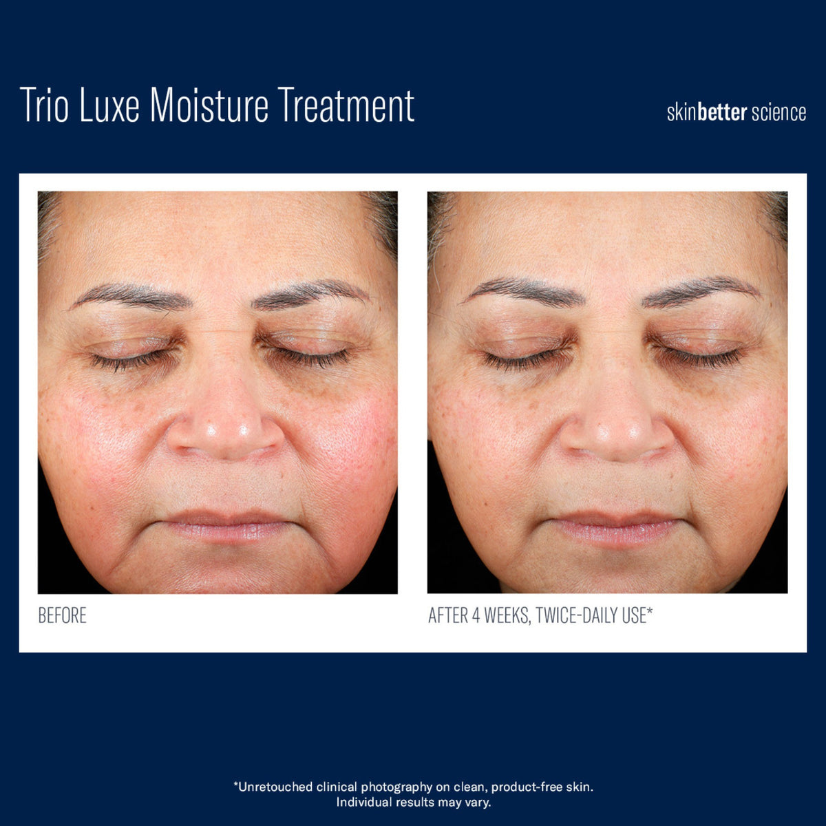 SkinBetter Science Trio Luxe Moisture Treatment lifestyle image