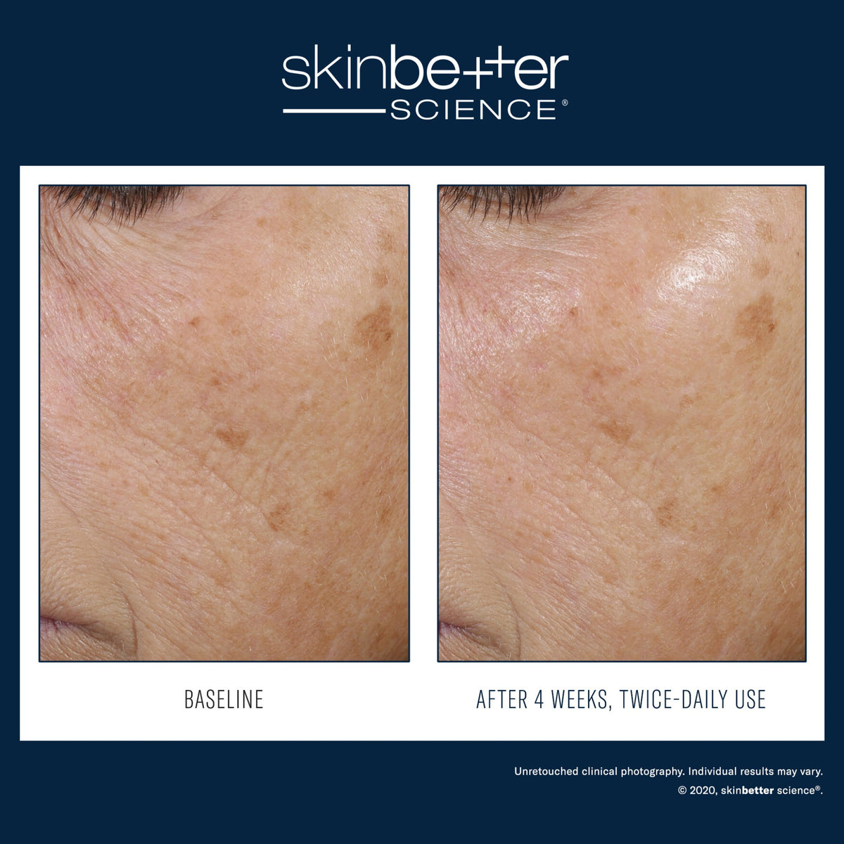 SkinBetter Science Trio Rebalancing Moisture Treatment lifestyle image