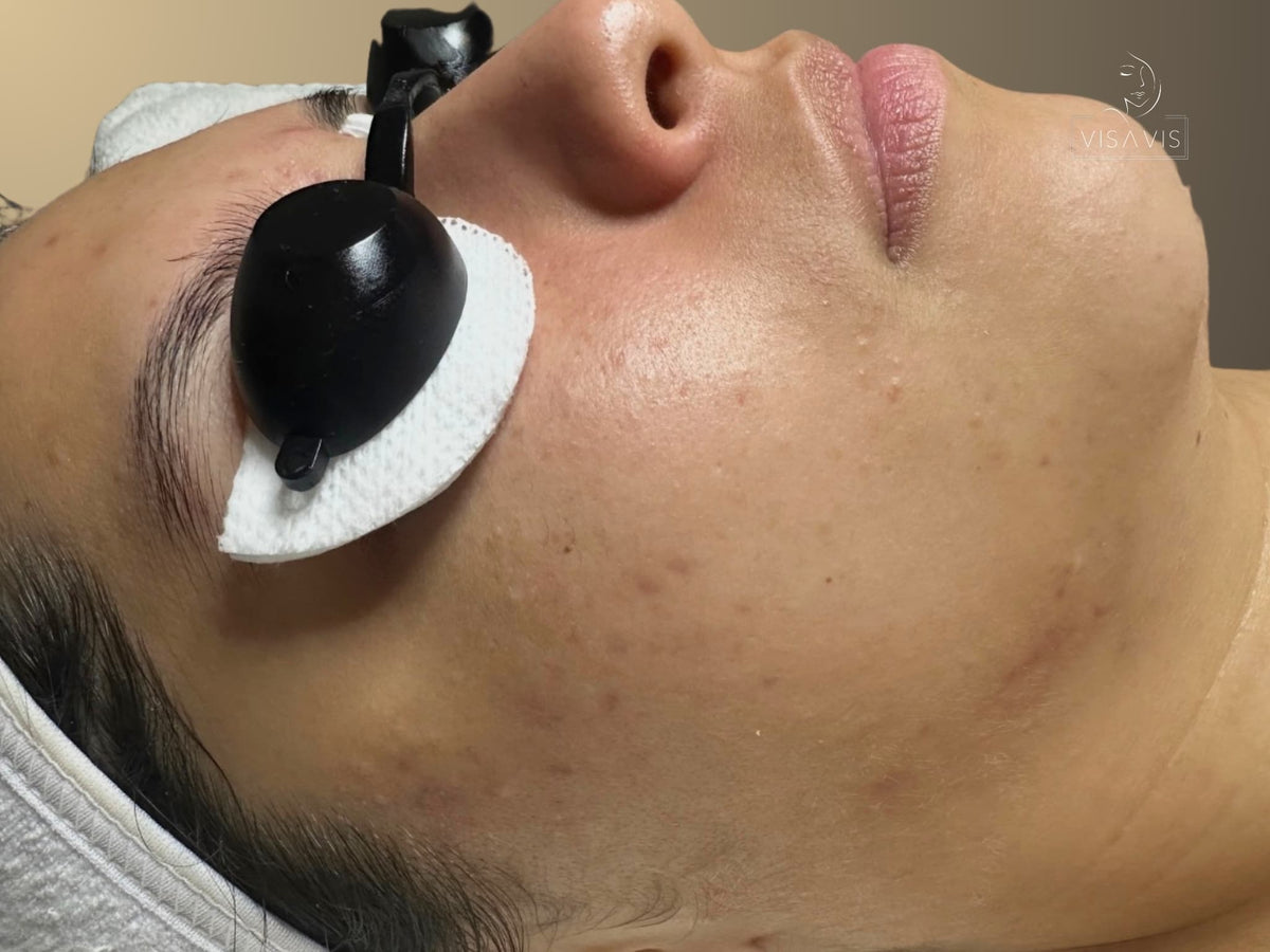 After treatment